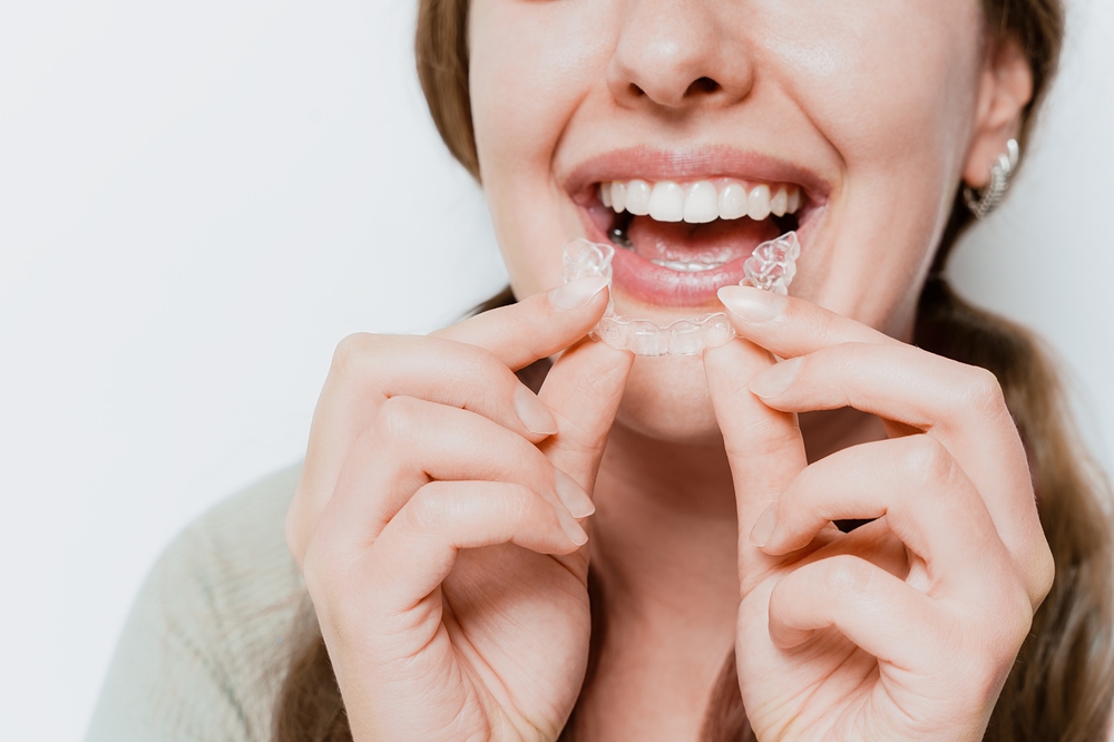 adult braces